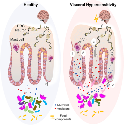 Figure 1. Diet–microbiota interactions leading to visceral hypersensitivity: proposed mechanisms and future directions.