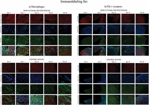 Figure 5. Tissue biopsy taken from FKDP +0.1%NaBu (upper panels) treated wound and control wound (lower panel) immunolabeled for a) macrophages (red), p53 (green), and cell nuclei (blue), b) Flk-1 (red), pancytokeratin (green), and cell nuclei (blue). Note the changes in immunoreactive cell numbers during the healing course.
