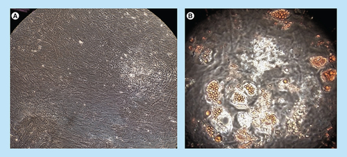 Figure 3. Mesenchymal stromal cell adipogenic differentiation.(A) Negative control; (B) mesenchymal stromal cell-derived adypocytes with oil red O-stained droplets evident.