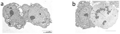 Figure 4. Transmission electron micrographs of the neuroblastoma SH-SY5Y cells. In panel a untreated cells are shown: the cells have regular nuclei (N) and organised cytoplasm. In panel b cells after DTX treatment are displayed: on the right an apoptotic cell is shown. Marginated chromatin is evident (arrow); the cytoplasm is devoid of organelles. Bar 12 μm.