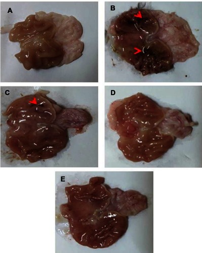 Figure 8 Gross appearance of freshly excised stomachs.Notes: (A) Normal control with normal gastric mucosa. (B) Positive control showing glandular mucosal ulcerations (red arrowheads) as well as extensive glandular and non-glandular mucosal congestion and edema. (C) Rats pretreated with diosmin (100 mg/kg) displaying moderate glandular mucosal ulcerations (red arrowheads), glandular and non-glandular mucosal congestion and edema were moderate. (D) Rats pretreated with an equivalent dose of uncoated PLGA nanoparticles exhibiting mild congestion and edema appeared in glandular and non-glandular gastric mucosa. (E) Apparently normal gastric mucosa of rats pretreated with an equivalent dose of chitosan-coated nanoparticles.Abbreviation: PLGA, poly(d,l-lactide-co-glycolide).