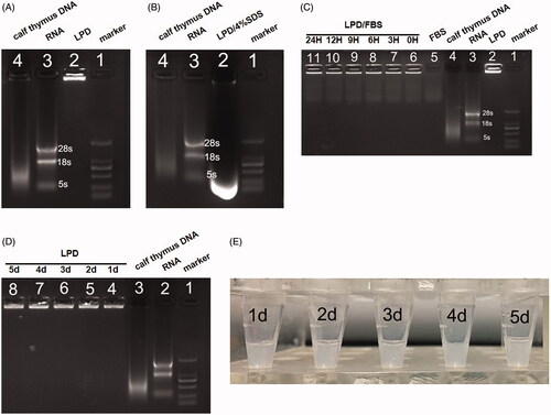 Figure 2. Gel retardation and stability assay of LPD nanoliposomes. (A) and (B) Gel retardation assay of LPD nanoliposomes. Lanes 1: DNA Marker; Lane 2: LPD nanoliposomes in the absence (A) or (B) presence of 4% SDS; Lane 3: pure RNA; Lane 4: calf thymus DNA. (C) Stability assay of LPD nanoliposomes. Lane 1: DNA Marker; Lane 2: LPD nanoliposomes; Lane 3: pure RNA; Lane 4: calf thymus DNA; Lane 5: FBS; Lane 6–11: LPD nanoliposomes mixed with FBS for 0, 3, 6, 9, 12, and 24 h. (D) Stability assay of LPD nanoliposomes. Lane 1: DNA Marker; Lane 2: pure RNA; Lane 3: calf thymus DNA; Lane 4–8: LPD nanoliposomes stored at 4 °C for 1, 2, 3, 4, and 5 days. (E) The images of LPD nanoliposomes stored at 4 °C for 1, 2, 3, 4, and 5 days.