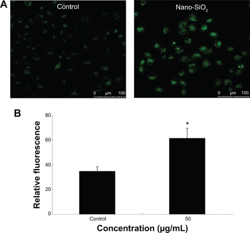 Figure 4 Detection of autophagic vacuoles induced by Nano-SiO2 via MDC staining.Notes: (A) Confocal microscopy images of MDC staining after HUVECs were exposed to 50 μg/mL of Nano-SiO2 for 24 hours. (B) Quantification of MDC staining by fluorescent intensity analysis. Student’s t-test is used for the data analysis. Data are expressed as the mean ± standard deviation from three independent experiments (*P<0.05).Abbreviations: Nano-SiO2, silica nanoparticles; MDC, monodansylcadaverine; HUVECs, human umbilical vein endothelial cells.