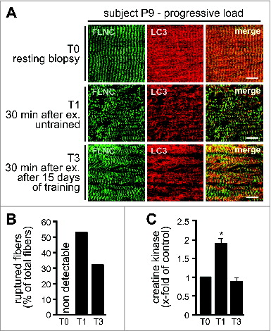 Figure 7. Long-term training reduces muscle fiber damage and rupture in response to resistance exercise with progressive load. (A) Localization of the indicated proteins in human vastus lateralis muscle fibers was performed by immunofluorescence microscopy. Scale bars: 10 μm. (B) Ruptured fibers were quantified in biopsies of subject P9. Total number of analyzed fibers was set to 100% (T0: n = 90; T1: n = 142, T2: n = 109). (C) Serum CK levels were determined in the subject cohort subjected to sustained resistance exercise with progressive load. Mean +/− SEM, n = 3, *P < 0.01.