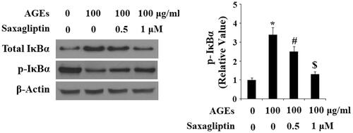 Figure 7. Saxagliptin inhibited phosphorylation and degradation of IκBα. Primary human chondrocytes were treated with 100 μg/ml AGEs in the presence or absence of 0.5 and 1 μM saxagliptin for 6 h. Phosphorylated and total IκBα were determined by western blot analysis (*, #, $, p < .01 vs. previous column group).