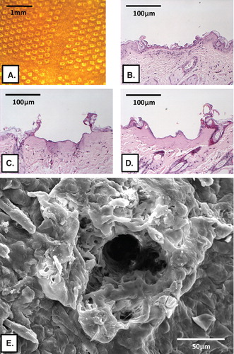 Figure 2. Histological analysis of laser-generated micropores in mouse skin. (A) Top view of skin after laserporation using 2 pulses (F = 1.9 J/cm2/pulse), 400 pores/cm2. Panels (B)–(D) show representative H&E-stained paraffin skin sections displaying a single pore after laserporation with 1 (B), 4 (C) or 8 pulses (D) delivered at 1.9 J/cm2/pulse. Panel (E) shows a SEM picture of a single pore generated by delivery of 8 pulses at 0.76 J/cm2/pulse.