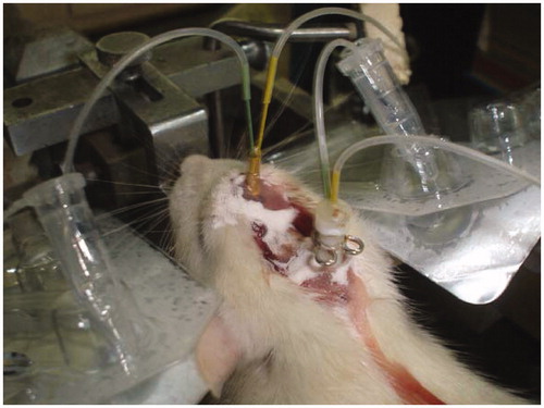 Figure 2. Scheme of microdialysis procedure.