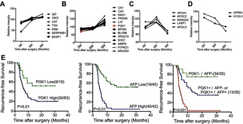 Figure 4 The prognostic value of PGK1 in HCC recurrence. Twenty-seven DAPs could be divided into four clusters: steady increase from 3 to 9 M (A), steady increase from 3 to 6 M then sharp increase from 6 to 9 M (B), sharp increase from 3 to 6 M but then sharp decrease from 6 to 9 M (C), and steady decrease from 3 to 9 M (D). The fold change curve of PGK1 was colored in red in the second cluster (B). (E) The prognostic values of PGK1/AFP serum levels and the combination of PGK1/AFP in RFS (log-rank test).Abbreviations: HCC, hepatocellular carcinoma; DAP, differentially abundant protein; AFP, alpha-fetoprotein; RFS, recurrence-free survival.