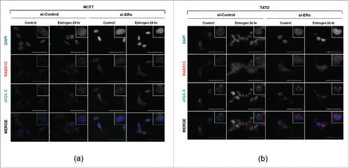 Figure 4. Estrogen induces RAD51C foci assembly in ERα dependent manner. (A) T47D cells were transfected with scrambled siRNA, or siRNAs against ERα and either serum-starved or stimulated with estrogen for 24 hr. Immunofluorescence was performed as described in “Materials and Methods.” Scale bar represents 50 μm. (B) MCF7 cells were treated and processed as described in (A).