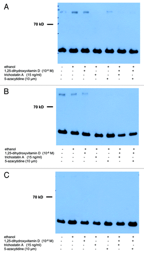 Figure 2. Treatment with UV-B, 1,25(OH)2D3 and epigenetic drugs, alone or in combination, does not exert strong effects on protein expression of Notch-1 in non-malignant and in malignant human keratinocytes. Western analysis revealed that Notch-1 protein is expressed in cultured non-malignant (HaCaT keratinocytes) and malignant (SCL-1 cells) human keratinocytes. Results of representative experiments in HaCaT keratinocytes 48 h after UV-B irradiation are shown here. Please note that treatment with UV-B [(A) 0 J; (B) 100 J; (C) 500 J] and/or 1,25(OH)2D3 (10−8 M) does not exert strong effects on protein expression of Notch-1 after 24, 48 or 72 h. Please also note that treatment with epigenetic modulating drugs (TSA, 5-Aza) does not exert strong effects, alone or in combination with UV-B and/or 1,25(OH)2D3, on protein expression of Notch-1 in HaCaT keratinocytes. Western analysis of GAPDH protein (lower band) served as control.