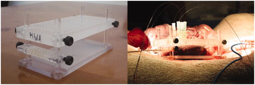 Figure 1. MWA in in-vivo porcine kidneys with fiber optic thermal sensors inserted through the acrylic apparatus perpendicular to the microwave antenna axis plane.