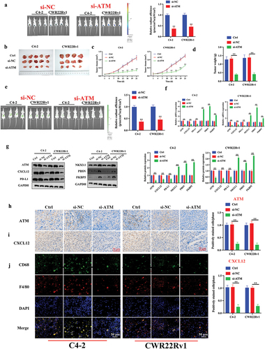 Figure 8. ATM promotes CRPC and macrophage recruitment in vivo. a. luminescence of tumor formation after three weeks. b. photograph of CRPC cell lines induced transplantation tumors. c, d. the volume and weight of the transplantation tumors. e. epi-fluorescence was employed to assess the ability of CRPC cells to attract macrophages. f, g. the level of mRNA and protein expression of ATM, CXCL12, PD-L1, NKX3.1, PBSN, and FKBP5 in transplantation tumor tissues. GAPDH was used for normalization. h, i. the expression of ATM and CXCL12 in the transplantation tumor tissues was evaluated by an immunohistochemical analysis. Scale bar = 50 μm. j. immunofluorescent staining of CD68 (green) and F4/80 (red) in transplantation tumor tissues. Scale bar = 50 μm. Data are presented as the mean ± SD, n =5. *P < .05; **P < .01; ***P < .001. Data were analyzed by using two-way ANOVA with Tukey’s multiple comparisons.