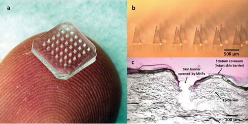Figure 1. Microneedle patch (MNP) for transdermal drug delivery. (A) Representative MNP. (B) Magnified view of microneedles. (C) Image showing skin histology after puncture with a microneedle. Images reproduced with permission from JW Lee, Georgia Tech.