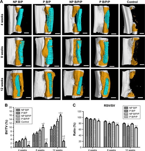 Figure 7 Micro-CT imaging and osteogenic analysis.Notes: (A) Micro-CT scans and 3D reconstructions to visualize healing of critical size bone defects in the rabbit radius at 4, 8, and 12 weeks after implantation of scaffolds seeded with BMSCs. Defects were implanted with NP B/P scaffolds, P B/P scaffolds, NP B/P/P scaffolds, P B/P/P scaffolds, or no scaffold (control). The scaffolds are shown in blue, and newly formed radius bone is shown in dark orange in the micro-CT images; scale bars: 3 mm. (B) Bone volume fraction. (C) RSV/SV values. Results are mean ± standard deviation (χ ± SD), n=9; αP<0.05 vs NP B/P scaffolds; βP<0.05 vs P B/P scaffolds; γP<0.05 vs NP B/P/P scaffolds; δP<0.05 vs P B/P/P scaffolds.Abbreviations: BMSCs, bone marrow-derived mesenchymal stem cells; BV, bone volume; 3D, three-dimensional; NP B/P, nonprinted biphasic calcium phosphate/polyvinyl alcohol; NP B/P/P, nonprinted biphasic calcium phosphate/polyvinyl alcohol/platelet-rich fibrin; micro-CT, micro-computed tomography; P B/P, printed biphasic calcium phosphate/polyvinyl alcohol; P B/P/P, printed biphasic calcium phosphate/polyvinyl alcohol/platelet-rich fibrin; RSV, residual scaffold volume; SV, scaffold volume.