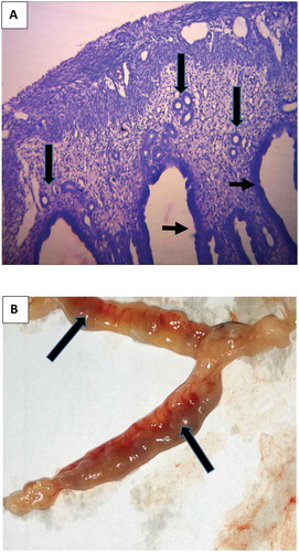 Figure 2. Section of (a) Oviduct of mice treated with E. chlorantha extract: showing well-formed glands (long arrows) in the endometrial submucosa. The epithelia lining is normal (short arrows), H and E × 400 (b) Uterus of mice treated with E. chlorantha extract showing fetal resorption (long arrows) Mag ×1.5