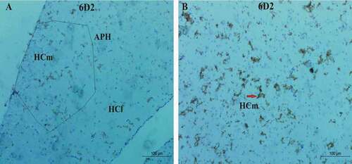 Figure 7. Photomicrograph of Corvus cornix hippocampus stained by 6D2 antibody showing the expression of proteoglycan protein (a) rostral, (b) medial hippocampus. Bar: A-B = 100 µm