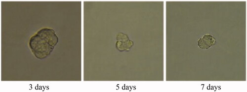 Figure 39. Celastrol AuNP (CA) treatment group for 3D tumour spheroid. Scale bar = 100 μm.