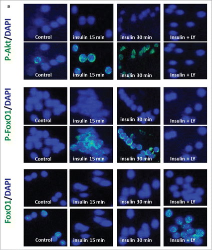 Figure 4. Insulin induces p-Akt and p-FoxO1 expression in human CD3-activated T cells. Activated T cells were treated with insulin (1 µM) in the absence or presence of the PI3K inhibitor LY294002 for different time points and analyzed by immunofluorescence staining. Merged confocal microscopic images show p-Akt, p-FoxO1, FoxO1 (FITC) (pseudo-colored in green) and DAPI (pseudo-colored in blue) upon stimulation with insulin (1 µM) for 15 and 30 minutes.