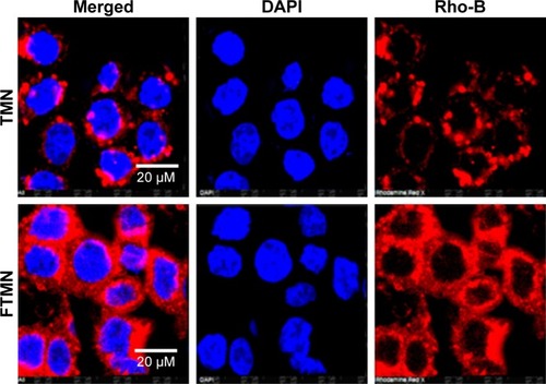 Figure 4 Colocalization of TMN and FTMN in Y79 cancer cells. The study was performed by CLSM. Scale bar: 20 µm.Abbreviations: CLSM, confocal laser-scanning microscopy; DAPI, 4′, 6-diamidino-2-phenylindole; TPT, topotecan; TMN, TPT-loaded mesoporous silica nanoparticles; FTMN, TPT-loaded mesoporous silica nanoparticles surface conjugated with folic acid; Rho-B, Rhodamine B.