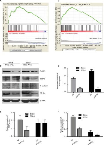 Figure 3 AP-2α expression with focal adhesion as well as notch signaling.Notes: (A and B) The Gene Set Enrichment Analysis results showing the correlation of AP-2α- and PTC-related gene sets in MSigDB. Gene sets “notch signaling” and “focal adhesion” were enriched in AP-2α high expression phonotype. (C–F) Western blot analysis for the protein level of Notch1, MMP2, and AP-2α in PTC (BCAPAP and TPC-1) cell lines transfected with AP-2α siRNA for 24 hours.Abbreviations: AP-2α, activator protein 2α; MSigDB, the Molecular Signature Database; NC, negative control siRNA; PTC, papillary thyroid carcinoma.