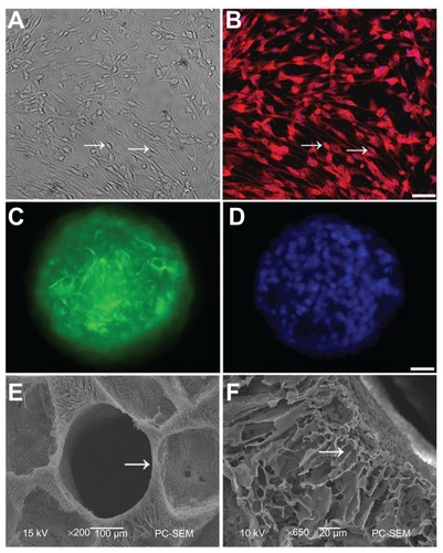 Figure 1 Schwann cells (SCs) and neural stem cells (NSCs) culture and identification. (A) SCs (arrow) were viewed under light microscopy; (B) Cell bodies (arrow) were stained with antibodies against S100 and nuclei were labeled by DAPI; (C) Neurospheres were stained with antibodies against nestin, a marker of NSCs; (D) Nuclei in the neurosphere were labeled by DAPI. Scale bar = 20 μm in (A–B) and 10 μm in (C–D); (E) SEM of a transverse section of PLGA scaffold shows one of the tubes (arrow). There are numerous pores with variable diameters between tubes; (F) A longitudinal section of PLGA was imaged under high SEM.Note: The arrow points to the radial channel that extends from the scaffold tube.Abbreviations: DAPI, 4′,6-diamidino-2-phenylindole; SEM, scanning electron microscope; PLGA, poly-(lactic acid-co-glycolic acid).