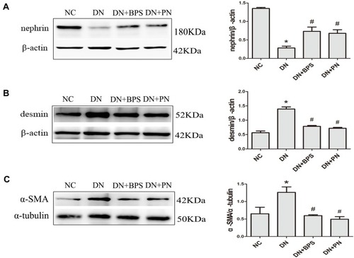 Figure 5 Effects of PN treatment on protein expression of nephrin, desmin, and α-SMA in diabetic rats. Representative immunoblots stained for nephrin (A), desmin (B) and α-SMA (C) in the kidney. PN and BPS were administered once daily by oral garage for 12 weeks. Results were expressed as the mean ± SEM. *P<0.05 vs NC; #P<0.05 vs DN.