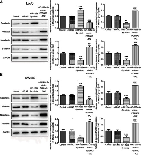 Figure 4 miR-125a-5p inhibits epithelial–mesenchymal transition of CRC cells via directly targeting TAZ. Western blot was used to examine the protein expression of EMT markers E-cadherin, N-cadherin, vimentin and β-catenin in LoVo (A) and SW480 (B) cells transfected with miR-NC, miR-125a-5p mimic or co-transfected with miR-125a-5p mimic and TAZ overexpression plasmids. Dates are expressed by mean ± standard deviation. **P<0.01, ***P<0.01 vs miR-NC. ##P<0.01, ###P<0.01 vs miR-125a-5p mimic.Abbreviations: miR-NC, microRNA mimic control; PCDNA3-TAZ, TAZ overexpression plasmids.