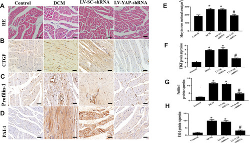 Figure 2 HE staining, CTGF, Profilin-1, and PAI-1 protein expression in the myocardium in vivo (n=6). (A -D) Representative HE staining and immunohistochemical staining of CTGF, Profilin-1 and PAI-1 in the 4 groups (scale bar=20 μm). (E-H) Quantitative analysis of CTGF, Profilin-1, and PAI-1 protein expression. *P<0.05 versus control group; #P<0.01 versus LV-SC-shRNA group.