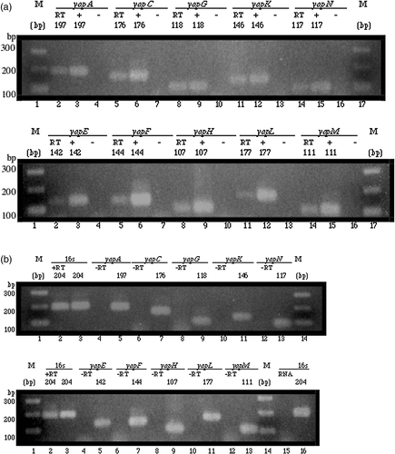 Figure 2.  Expression of yap genes in Y. pestis KIM analysed by RT-PCR. Amplicon sizes are indicated above each panel in base pairs (bp). M: molecular markers. Each lane contained 5 µl of a 25 µl reaction resolved on a 2% agarose gel. (a) In both panels, RT-PCR products of yap genes (RT) are shown in lanes 2, 5, 8, 11, and 14; positive PCR control reactions (+) are shown in lanes 3, 6, 9, 12, and 15; and negative PCR control reactions (−) are shown in lanes 4, 7, 10, 13, and 16. The RT-PCR reactions included cDNA as template. The positive PCR reactions included genomic DNA as template. No template was used in the negative PCR reactions. (b) In both panels, positive RT control reactions (+RT) are shown in lane 2; and, negative RT control reactions (−RT) are shown in lanes 4, 6, 8, 10, and 12. Shown side-by-side in lanes 3, 5, 7, 9, 11, and 13 are positive PCR control reactions. The positive RT control reactions included cDNA as template and primers targeting the 16s rRNA gene. The negative RT control reactions contained the PCR amplified products of a negative control performed during reverse transcription. Shown in lane 15 is a control reaction that included 2.4 µg of cleaned RNA as template and primers targeting the 16s rRNA gene; shown side by side in lane 16 is a positive PCR control reaction.