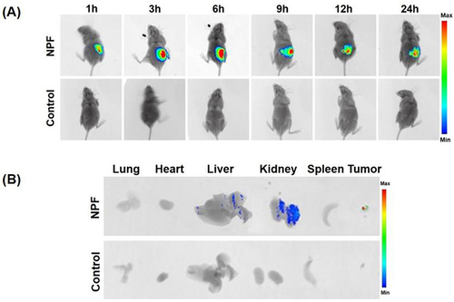 Figure 6 Tumor-specific infiltration using nanocarrier fluorescence. (A) In vivo imaging of CAL-27 tumor-bearing mice 1, 3, 6, 9, 12, and 24 h after intravenous injection of NPF-Cy5.5 or NS. (B) Ex vivo fluorescence images of NPF in the tumors and major organs/tissues after intravenous injection.