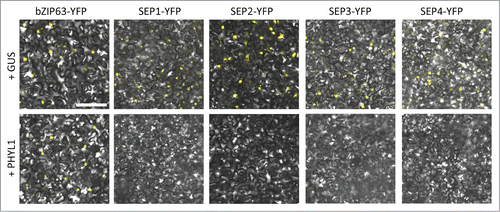 Figure 1. PHYL1 induces the degradation of SEP1–4 proteins. Agrobacterium cultures (OD600 = 1.0) for transient expression of YFP-fused proteins (bZIP63 and SEP1–4) and GUS or PHYL1 protein were mixed at a ratio of 1:10 and infiltrated into Nicotiana benthamiana leaves. The accumulation and subcellular localization of the transiently expressed YFP-fused proteins were observed 50 h after infiltration. Scale bar = 100 µm. The Agrobacterium strain and plasmids were the same as in the previous study, respectively.Citation15 The composition of the infiltration buffer is as follows: 10 mM morpholinepropanesulfonic acid (MES, pH 5.6), 10 mM MgCl2, and 150 µM acetosyringone. Nuclear localization of the transcription factors used in this study was confirmed by DAPI staining (data not shown).