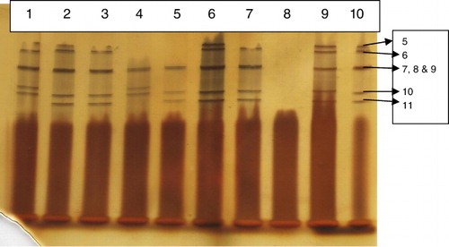 Figure 4. RNA-PAGE showing segments of rotavirus extracted from stool samples of children.
