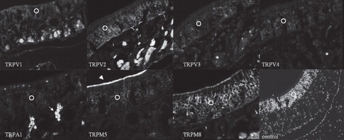 Figure 1. Immunofluorescent reaction to TRPV1 is evident in olfactory receptor neurons (ORNs). Supporting cells and basal cells are less intensely immunofluorescent. In lamina propria, nerve fibers (NFs) are immunofluorescent (TRPV1). Immunofluorescence to TRPV2 is evident in ORNs. Basal cells are markedly immunofluorescent. NFs are intensely immunofluorescent (TRPV2). Immunofluorescence to TRPV3 is observed in the ORNs. NFs show weak immunofluorescence (TRPV3). Immunofluorescence to TRPV4 is observed in the ORNs. In the lamina propria, TRPV4 labeling is weak and absent in NFs (TRPV4). The ORNs show immunofluorescence to TRPA1. Bowman's glands show marked immunofluorescence (TRPA1). Moderate immunofluorescence to TRPM5 is noted in the ORNs. Olfactory cilia are intensely immunofluorescent (TRPM5). Intense immunofluorescence to TRPM8 is observed in the ORNs. Olfactory cilia and basal cells are moderately immunofluorescent. NFs show marked immunofluorescence (TRPM8). Control staining without primary antibodies does not elicit immunofluorescence. Nuclei are counterstained with DAPI (control). O, ORNs; asterisk, nerve fiber; arrow, Bowman's gland; arrowhead, olfactory cilia.