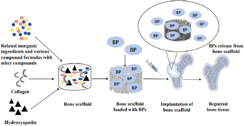 Figure 2 Mechanism of bone tissue engineering combined with bisphosphonates to repair bones. The process shown here is to construct a bone scaffold with biomaterials and scaffold materials, load bisphosphonate on the bone scaffold, inject it into the bone defect site to repair the bone defect, and release BP molecules to inhibit osteoclast absorption and tumor growth.