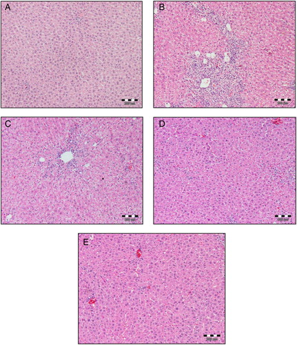 Figure 3. Histopathological changes in rat livers (H&E). Dose regimens and treatment protocols are described in material and method section. (A) Control liver; (B) rat liver challenged with CCl4; (C) rat liver challenged with CCl4 and pre-treated with A. paniculata (100 mg/kg b.w.); (D) rat liver challenged with CCl4 and pre-treated with A. paniculata (200 mg/kg b.w.); (E) rat liver challenged with CCl4 and pre-treated with A. paniculata (300 mg/kg b.w.), magnification 100 ×.