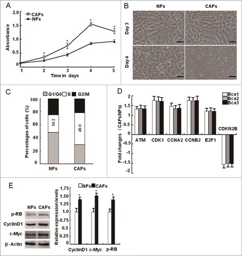 Figure 1. A strong proliferation potential of breast CAFs. (A) Growth curves of the paired immortalized NFs and CAFs were performed with MTT assay at designed time points. (*, P < 0.05). (B) Phase contrast photomicrographs of NFs and CAFs after incubation for 3 d (upper panel) and 4 d (lower panel). Scale bars, 50 μm. (C) The cell ratio in S-phase was analyzed using the flow cytometry. (*, P < 0.05). (D) The dysregulated expression of ATM and cell cycle regulating genes was re-proved in 3 pairs of primary NFs and CAFs from breast cancer patients by qRT-PCR. (*, P < 0.05). (E) The levels of p-RB, cyclin D1, and c-Myc were determined by Western blot. (*, P < 0.05).