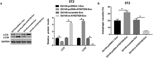 Figure 9. LncAY927529 in exosomes regulated bone microenvironment by mediating autophagy of bone stromal cells. (a) Western blot assay was uesd to detect LC3I and LC3II protein levels in ST2 cells treated with exosomes derived from DU145 with knockdown of AY927529 or overexpression of AY927529 for 48 h, and the conditioned medium (ST2-CM) was collected. (b) Autophagic vacuoles (%) was measured by immunofluorescence staining assay. *P < 0.05 compared with DU145-pcDNA3.1-Exo group or DU145-scramble-Exo group. N = 4, data were expressed as mean ± SEM; Student’s t test or one-way ANOVA was used for analyzing data