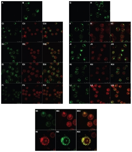 Figure 3 (A–F, M) Laser confocal fluorescence images of K562 cells incubated with various formulations for 1 hour at 37°C (magnification ×200 or ×600). (G–L, N) Laser confocal fluorescence images of MDR K562/ADR cells incubated with various formulations for 1 hour at 37°C (magnification ×200 or ×600). (A and G) Treated with PBS as a blank control. (B and H) Treated with PBS and stained with MitoTracker Green. (C and I) Treated with free epirubicin (10 μM) and stained with MitoTracker Green. (D and J) Treated with epirubicin liposomes (10 μM epirubicin) and stained with MitoTracker Green. (E and K) Treated with anti-resistant epirubicin liposomes (10 μM epirubicin plus 10 μM amlodipine) and stained with MitoTracker Green. (F, L, M and N) Treated with anti-resistant epirubicin mitosomes (10 μM epirubicin plus 10 μM amlodipine) and stained with MitoTracker Green.Notes: (i) Green channel: MitoTracker Green® (InvivoGen Corporation agent, Beijing, China) stained mitochondria. (ii) Red channel: epirubicin. (iii) Composite images of (i) and (ii). The bright yellow fluorescence in Fiii, Liii, Miii, and Niii shows that anti-resistant epirubicin mitosomes are co-localized into the mitochondria of both K562 and MDR K562/ADR cells, demonstrating that the anti-resistant epirubicin mitosomes are selectively accumulated into the mitochondria of both leukemia cells.Abbreviations: MDR, multidrug resistant; PBS, phosphate-buffered saline.