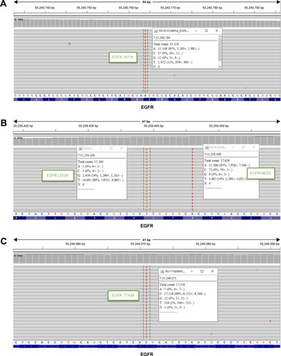 Figure 2 Next-generation sequencing showed R670W in epidermal growth factor receptor exon 17 (A), and H835L, L833V (B), and T790M (C) in exon 21.