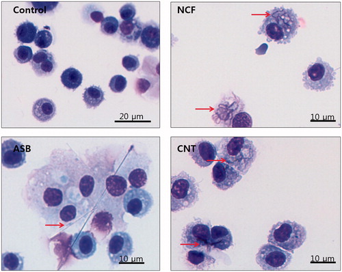 Figure 2. Representative images of the BAL fluid cells from mice at Day 14 post-exposure to ASB, NCF, or CNT. All stained with hematoxylin–eosin. Arrows point to the respective particles visible inside the cells. CNC are not seen under the conventional light microscopy.