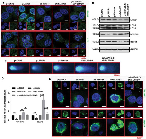 Figure 9. MIR-G-1 plays an oncogenic role in cervical cancer cells by regulating LMNB1expression. (a) IF assay showed the expression levels of LMNB1 and LC3 in HeLa cells during starvation at 24 h treated with the indicated plasmids. Scale bar: 20 μm. (b) Western blot assay showed the expression levels of LC3, SQSTM1, BECN1 and LMNB1 during starvation at 24 h after transfection with the indicated plasmids in HeLa cells. (c) Comet assays showed the degree of DNA breaks in HeLa cells transfected with the indicated plasmids treated with 10 µg/ml TAX for 4 h. Scale bar: 50 μm. (d) RT-qPCR showed the mRNA levels of TP53BP1 and H2AFX in HeLa cells transfected with the indicated plasmids under 10 µg/ml TAX treatment at 4 h in HeLa cells. (e) IF assay showed the TP53BP1 and H2AFX foci in HeLa cells tansfected with the indicated plasmids and treated with 10 µg/ml TAX for 4 h. Scale bar: 20 μm. Experiments were performed 3 times, and data are presented as means ±SD.*P < 0.05; **P < 0.01; ***P < 0.001; ns, not significant.