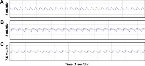 Figure 3 Maximal expiratory flow-volume curves.Notes: In each image, the peaks (upper) represent the expiratory phase and the troughs (lower) the inspiratory phase. Compared with controls (A), the CSE group (B) and CSE + 5-Aza-CdR group (C) showed abrupt ascents, and descending limbs showed a prolonged expiratory phase.Abbreviations: CSE, cigarette-smoke extract; 5-Aza-CdR, 5-Aza-2′-deoxycytidine; sec, second; div, division.