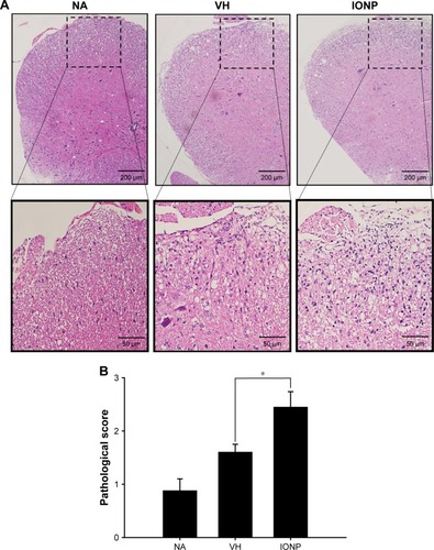 Figure 5 Treatment with ferucarbotran augmented the infiltration of inflammatory cells into the spinal cord of EAE mice.Notes: (A) Representative tissue sections stained with H&E are shown. The lower panels are enlarged images of dashed boxes that show a more severe infiltration of inflammatory cells in the IONP group. (B) Pathological scores of the inflammatory cell infiltration, assessed as described in “Materials and methods” section. The pathological scores were expressed as the mean ± standard error of 8–11 samples per group. *P<0.05 compared to the VH group. The results are representative of three independent experiments.Abbreviations: EAE, experimental autoimmune encephalomyelitis; IFN-γ, interferon-γ; IONP, iron oxide nanoparticle; NA, naïve; VH, vehicle.