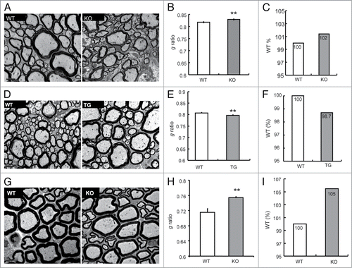 Figure 4. The effects of APP on myelination. (A) EM studies of cross-sections revealed the ultrastructure of myelin sheaths in spinal cords (SC) of WT vs. APP KO mice (all aged 3 mo). Scale bars: 2 μm. (B) The g ratio in APP WT and KO spinal cord was analyzed. Data are presented as mean ± SEM. **P < 0.01. (C) The g ratio in APP WT spinal cord was normalized as 100%. The relative g ratio in APP KO spinal cord was shown. (D) EM studies of cross-sections revealed the ultrastructure of myelin sheaths in the spinal cord (SC) of WT littermates vs. APP TG mice (all aged 3 mo). Scale bars: 2 μm. (E) The g ratio in APP WT and TG spinal cord was analyzed. Data are presented as mean ± SEM. **P < 0.01. (F) The g ratio in APP WT spinal cord was normalized as 100%. The relative g ratio in APP TG spinal cord was shown. (G) EM studies of cross-sections revealed the ultrastructure of myelin sheaths in sciatic nerves (SN) of APP WT and KO mice (all aged 3 mo). Scale bars: 5 μm. (H) The g ratio in the sciatic nerve of APP WT and KO at 3 mo old was analyzed. Data are presented as mean ± SEM. **P < 0.01. (I) The g ratio in APP WT sciatic nerve was normalized as 100%. The relative g ratio in APP KO sciatic nerve was shown.