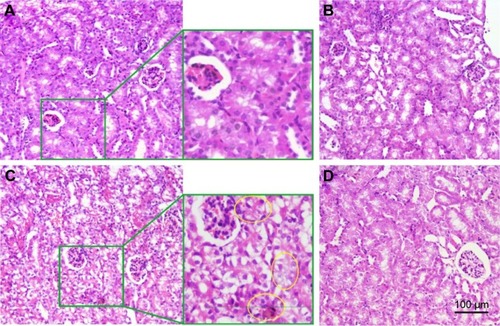 Figure 10 Effect of CMCNa, MSNS, 6MP plus CDDP and MSNS-6MP/CDDP on the left kidney histology.