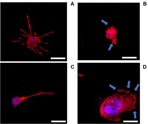 Figure 5 Actin staining epifluorescent images of human macrophages (A) LPS- DEX-; (B) LPS+ DEX-; (C) LPS+ DEX-P and (D) LPS+ DEX from release buffer after 24-hr exposure assessed by confocal microscopy. Actin rings and nuclei of cells were stained with phalloidin-FITC and DAPI, respectively; arrows indicate pseudopods. Bar corresponds to 20 µm.Abbreviations: LPS, lipopolysaccharides; DEX, dexamethasone; DEX-P, dexamethasone phosphate.