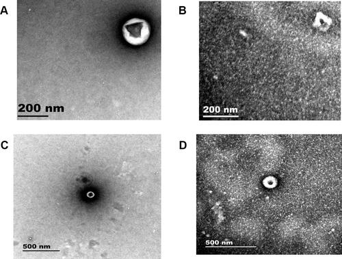 Figure 2 Identification of extracellular vesicles in hypopharyngeal cancer patients and healthy subjects. (A and B) SEM of extracellular vesicles (200nm) in healthy subjects and hypopharyngeal cancer patients, respectively. (C and D) SEM of extracellular vesicles (500nm) in healthy subjects and hypopharyngeal cancer patients, respectively.