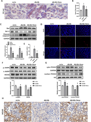 Figure 2 Fenofibrate ameliorates lipid accumulation and apoptosis and regulates AMPK/FOXA2/MCAD signaling in db/db mice. (A) Representative images of Oil Red O staining, Scale bar = 100 μm. (B) Renal triglyceride (TG), n=6. (C) Representative blots and a quantitation graph of Bax, Bcl-2 and Cleaved caspase 3 protein expression in the kidney, n=6. (D) Representative images of TUNEL staining. Apoptotic cells are visualized as red and nuclei are stained with DAPI (blue), Scale bar = 100 μm. (E) Quantitative analysis for the number of TUNEL-positive cells. (F and G) Representative blots and a quantitation graph of p-AMPK, t-AMPK, MCAD, cyto-FOXA2, nuclear-FOXA2 protein expression in the kidney, n=6. (H) Representative micrographs showing kidney MCAD immunohistochemistry (IHC) staining, scale bar = 100 µm. Eight-week-old male mice were gavaged with saline or fenofibrate for 8 weeks. All data are presented as the means ± SEs. feno, fenofibrate. *P < 0.05 vs. the m/m mice group; &P < 0.05 vs. the db/db mice group.