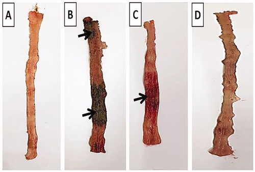 Figure 8. Macroscopic photographs of colon tissue after acetic acid-induced colitis in rats. (A) Normal group; (B) positive control group; (C) TMB group; (D) TMB-NLC group. Macroscopic damage score (black arrow).