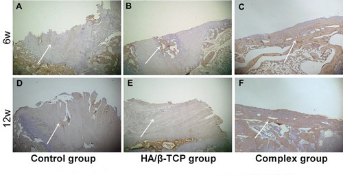 Figure 8 The images of osteocalcin immunohistochemical staining from three groups at 6 weeks (A–C) and 12 weeks (D–F) after surgery (40× magnification, scale bar =200 μm). The white arrow of picture is pointing to the surface of the spine defect area.